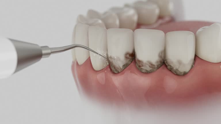 Reliable Dental Implants contractor in Opelika, AL by Smile Center Dentistry